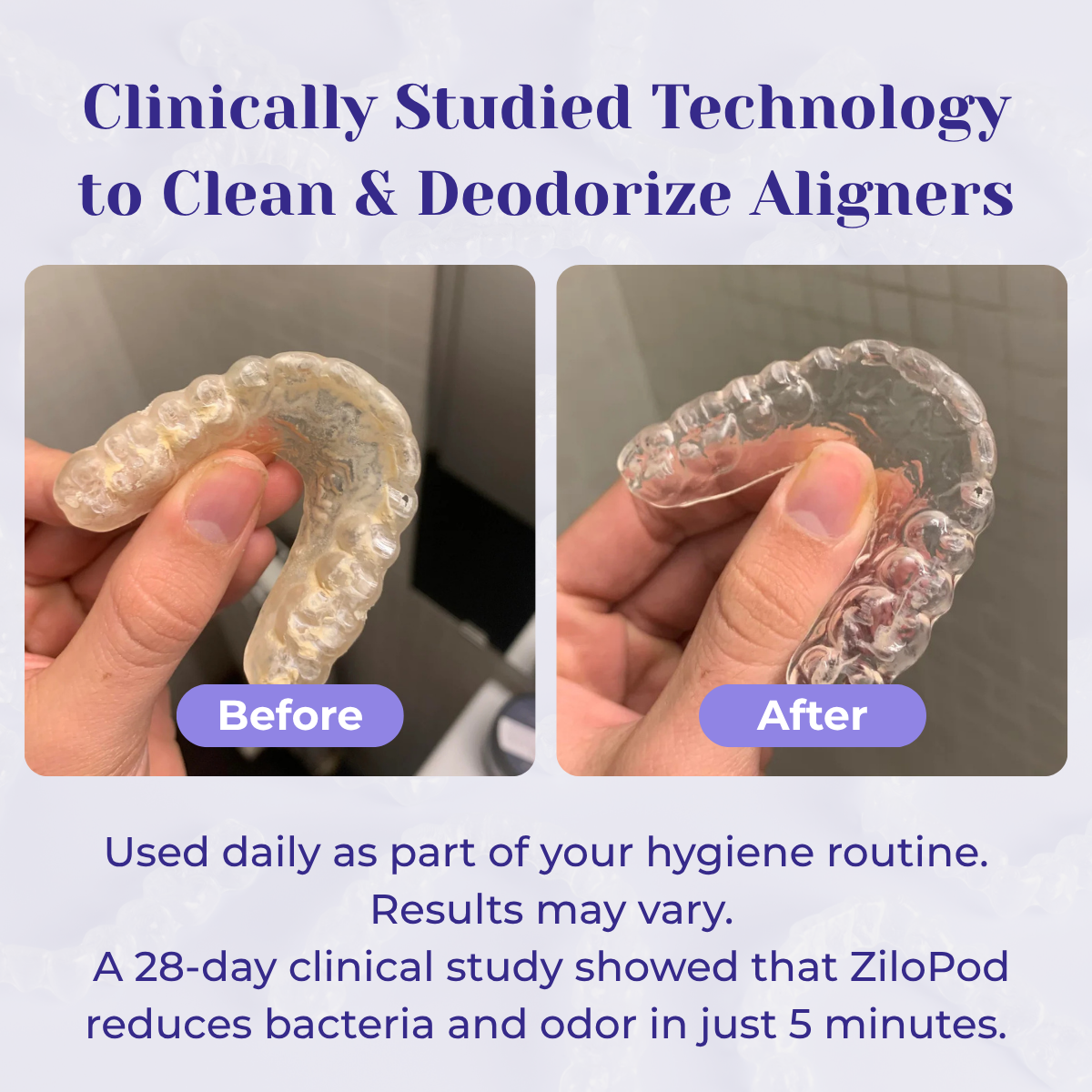 ZiloPod - #1 Dentist-Approved Ultrasonic & UVC Cleaner art